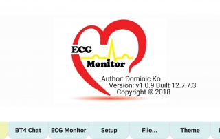 pqrst.ca ecg interpretation heart rhythm ecg-monitor bluetooth