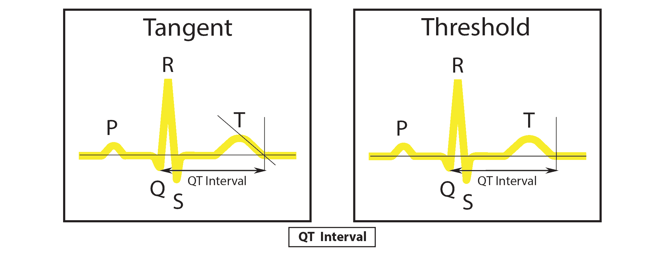 ECG Interpretation: QT-Analysis
