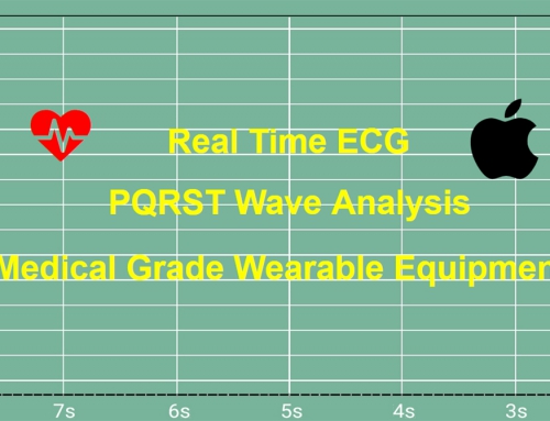 Real Time ECG – PQRST Wave Analysis – Medical Grade Wearable Equipment