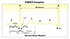 PQRST-Complex-的基本時序圖