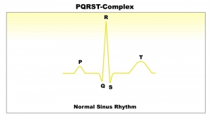 ECG Interpretation: Normal-Sinus-Rhythm-Single-Pulse