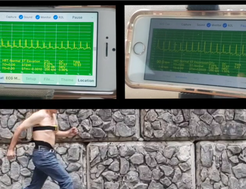 ecgMonitor Running Exercise in iPhone SE