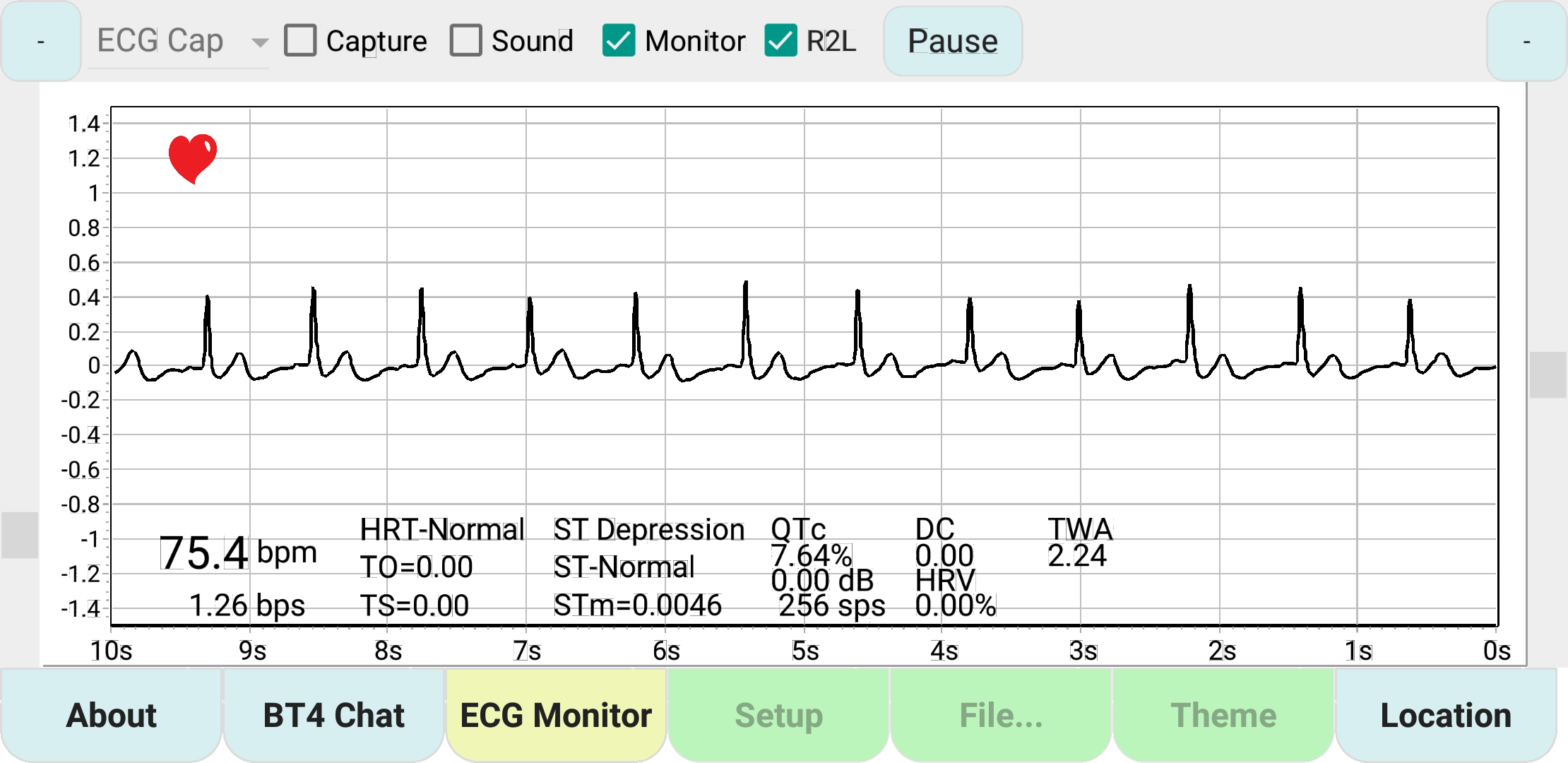 ecg_analysis_chart