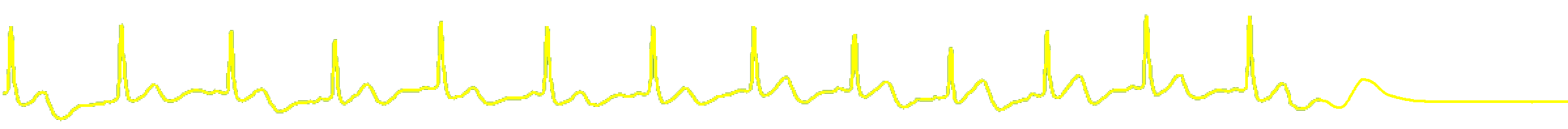 pqrst complex